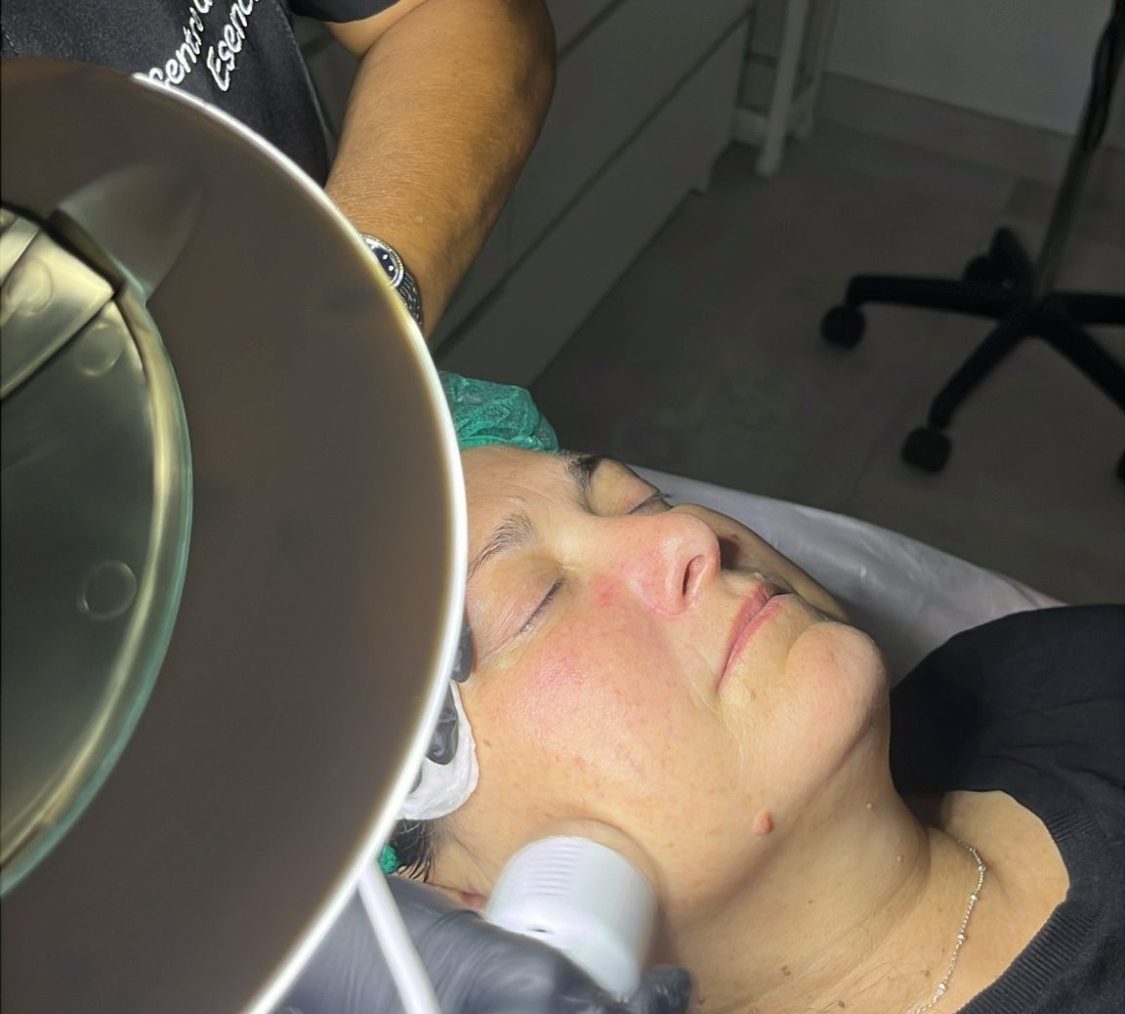 "Cliente recibiendo limpieza facial profunda con Hydrafacial para una piel más luminosa y revitalizada."